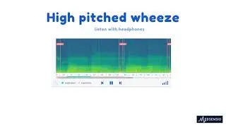 Lung sounds - high pitched wheeze