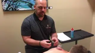 Cupping Physical Therapy Techniques