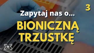 Zapytaj nas o&hellip; bioniczną trzustkę - odc 3