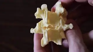 Intervertebral Joint