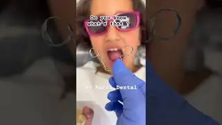 Space Maintainer,Orthodontics #oralhealth #kids#children#braces#viral#shorts #fashion
