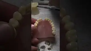&iquest;COMO REPARAR TU PR&Oacute;TESIS DENTAL SI SE LE CAE UN DIENTE?