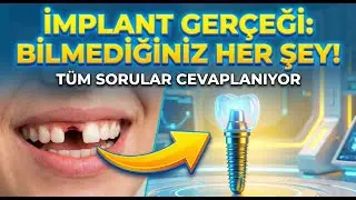T&uuml;rkiye'de All-on-6 diş implantı tedavisi,
