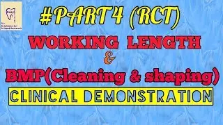Bio mechanical preparation of root canal, Working length determination of RCT (RCT PART -4)