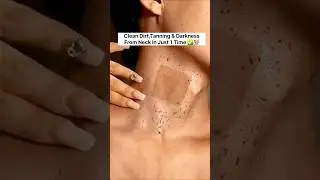 ✅ Neck Cleaning Tips | Dark Neck Home Remedies/Tanning Removel Tips #shorts #beauty #skincare #viral