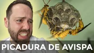 DE QUE ESTA HECHO EL VENENO DE UNA AVISPA