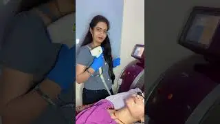 Laser Hair reduction ✅Alma laser Usfda approved in Bhopal #laserhairremoval #skincare #smoothskin