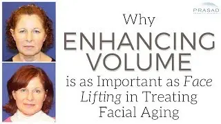 Why Volume Enhancement with a Facelift can Treat Areas Where Lifting is Limited Like Jowls