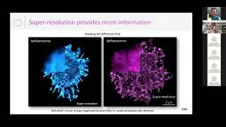 Single-Molecule Imaging At Your Fingertips