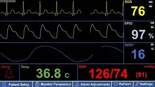 Simulated Adult Patient Monitor &ndash; NSR (Normal Sinus Rhythm)