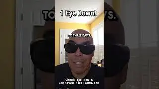 #cataract #surgery #pirate #arrrrgggg #eyepatch NielFlamm.com 