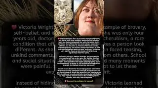 Victoria Wright's life is a powerful example of brave self - belief ❤️