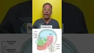What causes trigeminal neuralgia and nerve dysfunction headaches? #facialpain #headpressure