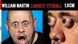 Unbelievable Human Body World Records | Longest  ,Hair, Widest Mouth & More!