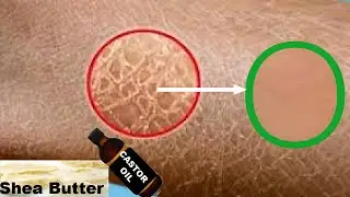 Быстрое решение проблемы сухости кожи | Лучшие советы, как сохранить кожу мягкой и гладкой