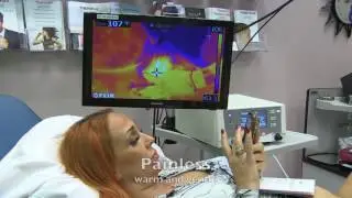 ThermiVa and O shot