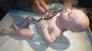 Cute Baby with Chest Infection 👶💨 | Gentle Nebulization Treatment Care