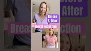 4 days before vs. 8 days after breast reduction surgery 💕 #breastreduction #shorts