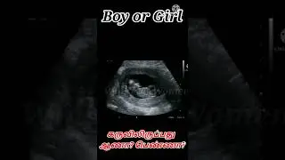 பிறக்கபோவது ஆணா?பெண்ணா?|#shorts|wingz of women|Boy or Girl|baby gender prediction|Girl baby symptoms