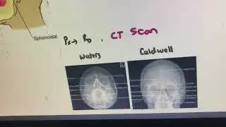 MATERI THT #edisi10   #cbt#ukdi#ukmppd#dokter#dokterumum
