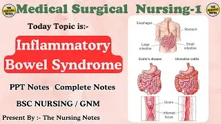 Inflammatory Bowel Syndrome (IBS) | Causes, Symptoms, Diagnosis & Nursing Management