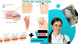 How many types of injection Type of|injection|Side of |injection|Route of administration|