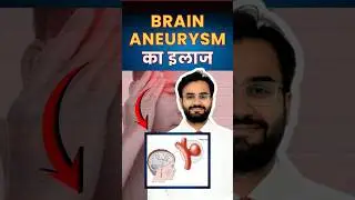 Top Neurosurgeon Reveals BEST Brain Aneurysm Treatment Techniques
