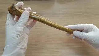 Ulna ve Radius Anatomisi (Ön kol kemikleri)