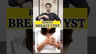 Best Exercise for Remote Breast Cyst #shorts #tranding #exercise