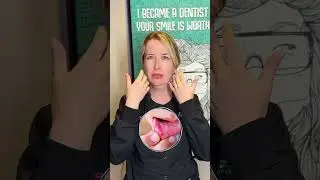 What happens after setting braces