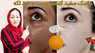ماسک وتأمین C برای هر نوع پوست بخصوص پوست های تیره و لکه‌دار و همچنان مرطوب کننده پوست میباشد 💯