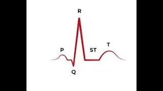 ECG - C4 (MI & Ischemia)  ccr