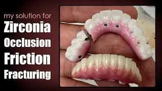 My Solution for Zirconia Occlusion Friction Fracturing