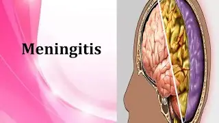 @#MENINGITIS for bsc nursing students #Definition ,,type ,cause etc# for medical student 