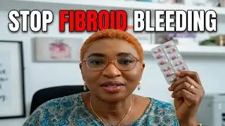 Stop Heavy Bleeding From Fibroids with These Effective Medications