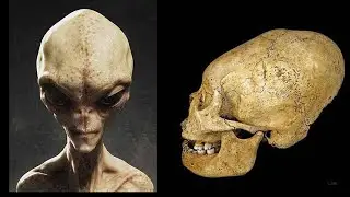 Elongated Skulls and ET's