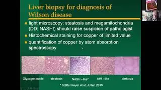 Wilson&rsquo;s Disease: Timely diagnosis, treatment and follow up by Dr. Peter Ferenci