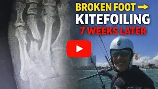 Back kitefoiling 7 weeks after metatarsal fracture