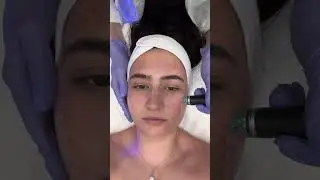 Come Get a Hydrafacial with Me!