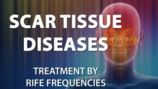 Scar Tissue Diseases - RIFE Frequencies Treatment - Energy & Quantum Medicine with Bioresonance