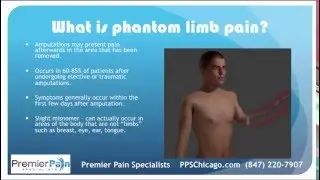 Overview of Phantom Limb Pain Treatment in Chicago (847) 220-7907