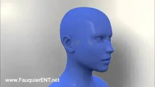 Síndrome Meniere GENYO