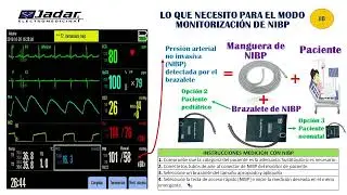 CAPACITACION DE DESFIBRILADOR DE MARCA MINDRAY MODELO D6