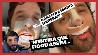 RAFINHA BASTOS DEIXOU DE SER NARIGUDO DEPOIS DA RINOPLASTIA?! | Lives ocaiodiniz