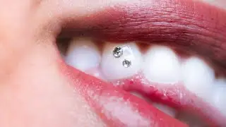 Tooth Gems