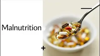 3. Malnutrition - Under Nutrition & Over Nutrition