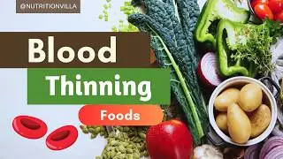 What Are The Best Natural Blood Thinners? 🧄 Top 10 Best Foods That Can Thin Your Blood