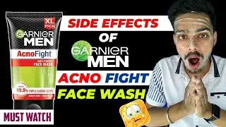 Good or Bad ? | Garnier Acno Fight Face Wash | Full Honest Review 2024