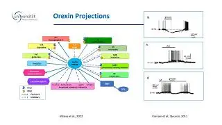 Narcolepsy and the orexin system