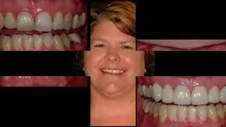 Waiting Room Video